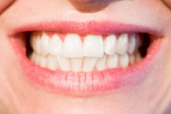 Magic Erasers To Whiten Their Teeth