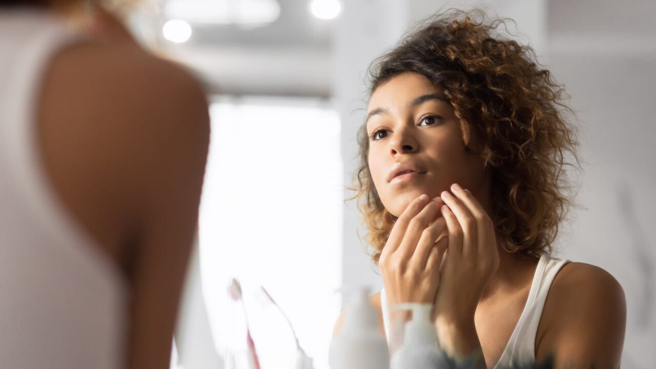 acne skin condition