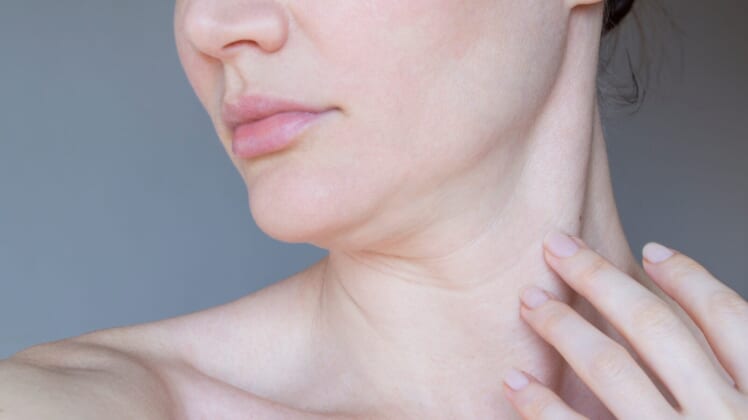 how to get rid of neck lines