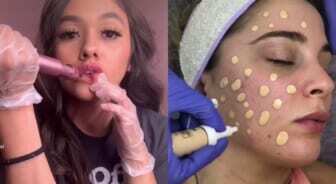 dangerous tiktok skincare trends