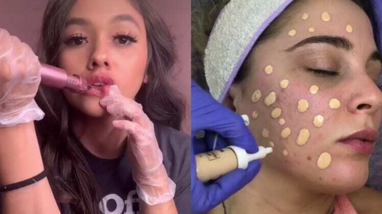 dangerous tiktok skincare trends