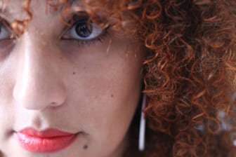 How To Cure Melasma