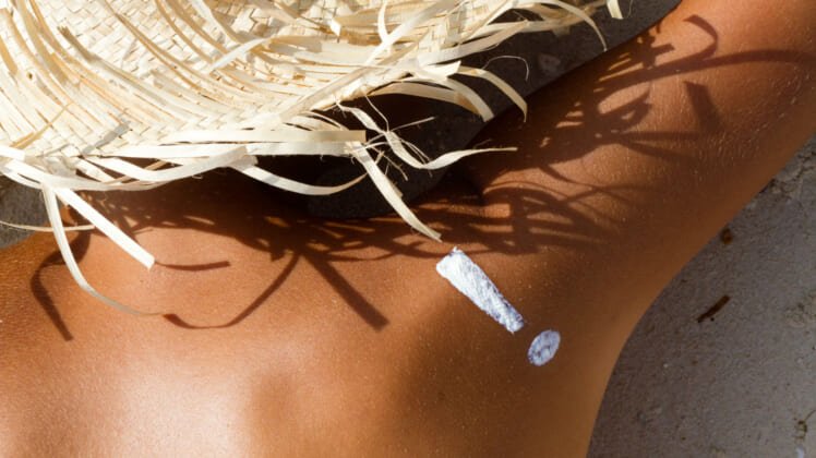 10 Surprising Things That Make A Sunburn Worse – And What You Should Do Instead 1