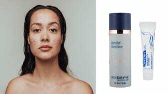 best products for adult acne