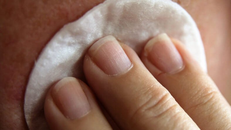 Best Moisturizers for Rosacea